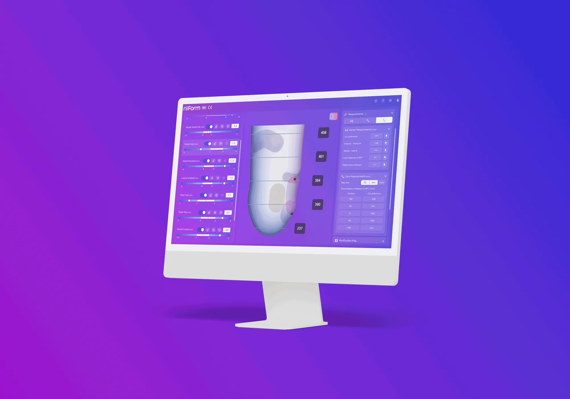 riiForm CAD software running on a desktop monitor, showing a 3D prosthetic socket model
